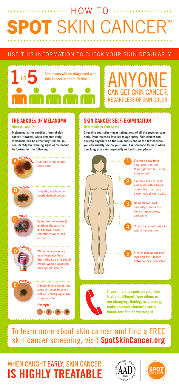 How_to_SPOT_Skin_Cancer_Infographic